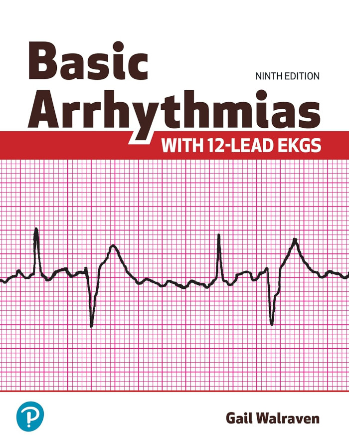 basic arrhytmias textbook